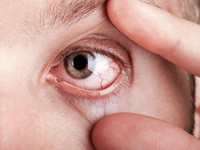 Visual representation of eye care tools