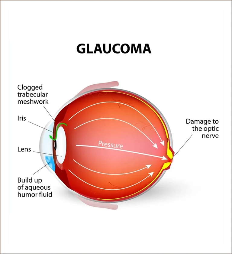 Cross-section diagram of an eye