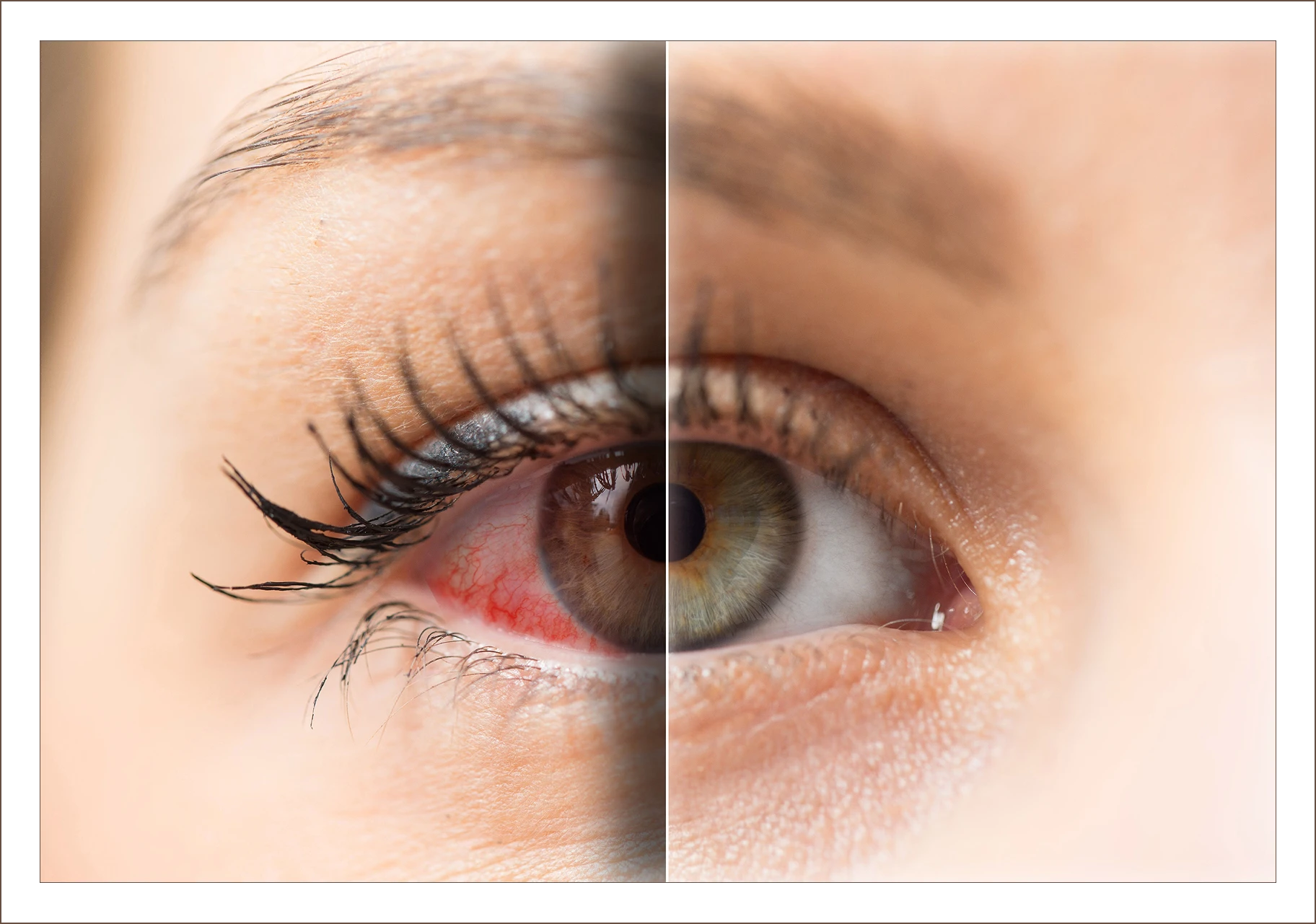 Half red and clear eye comparison