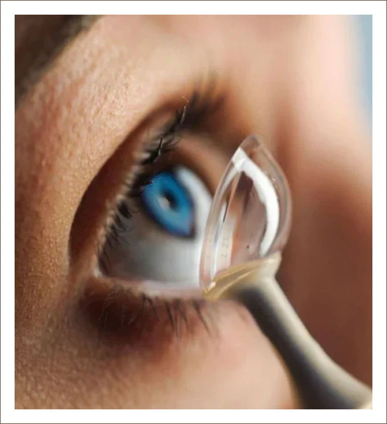 Applying a contact lens to the eye