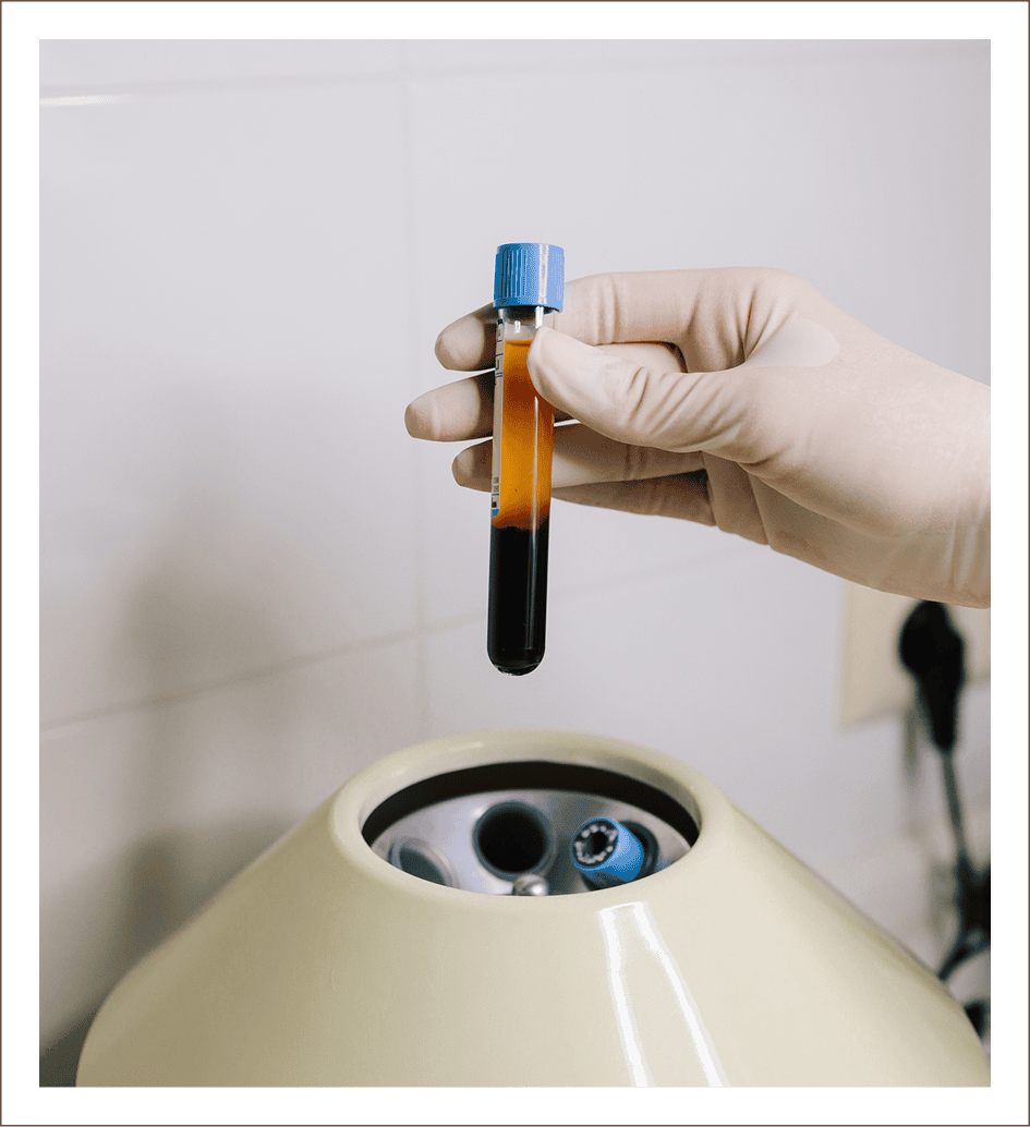 Gloved hand holding blood sample