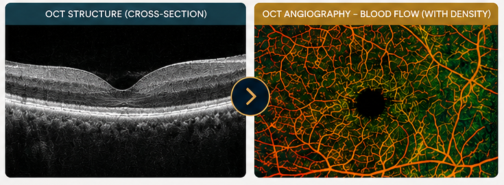 Cross-section of a human eye with an octangiography of blood flow with density